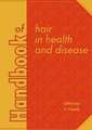 Handbook of hair in health and disease