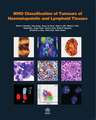 Who Classification of Tumours of Haematopoietic and Lymphoid Tissues [Op]