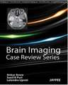Arora, A: Brain Imaging