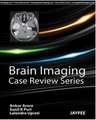 Brain Imaging: Case Review Series