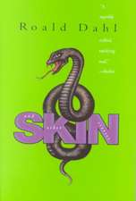 Skin and Other Stories