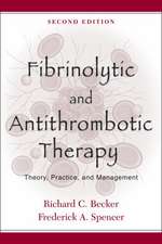 Fibrinolytic and Antithrombotic Therapy: Theory, Practice, and Management