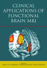 Clinical Applications of Functional Brain MRI