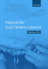 Paediatric Electromyography