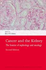 Cancer and the Kidney: The frontier of nephrology and oncology