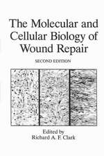 The Molecular and Cellular Biology of Wound Repair