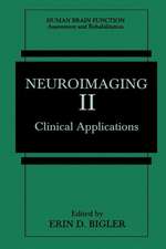 Neuroimaging II