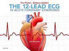 The 12-Lead ECG in Acute Coronary Syndromes