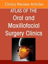 Perspectives on Zygomatic Implants, An Issue of Atlas of the Oral & Maxillofacial Surgery Clinics