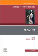 Brow Lift, An Issue of Clinics in Plastic Surgery