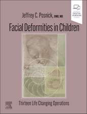 Facial Deformities in Children: Thirteen Life Changing Operations