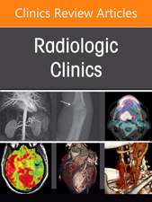 Imaging of Diffuse Lung Disease, An Issue of Radiologic Clinics of North America