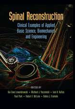 Spinal Reconstruction: Clinical Examples of Applied Basic Science, Biomechanics and Engineering