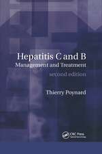 Hepatitis B and C: Management and Treatment