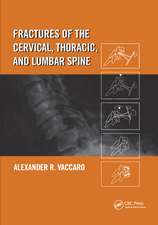 Fractures of the Cervical, Thoracic, and Lumbar Spine