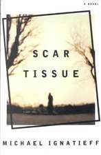 Scar Tissue