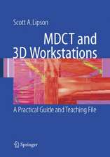 MDCT and 3D Workstations: A Practical How-To Guide and Teaching File