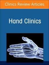 Contemporary Concepts in Treating the Rheumatoid Hand, An Issue of Hand Clinics