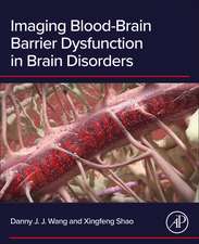 Imaging Blood-Brain Barrier Dysfunction in Brain Disorders