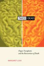 Twice Dead – Organ Transplants & the Reinvention of Death