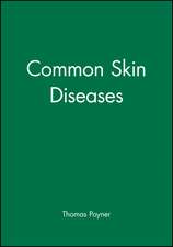 Common Skin Diseases