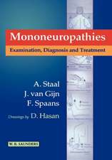 Mononeuropathies: Examination, Diagnosis and Treatment