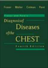 Fraser and Pare's Diagnosis of Diseases of the Chest