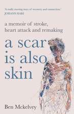 A Scar Is Also Skin