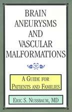 Brain Aneurysms and Vascular Malformations