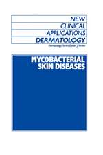 Mycobacterial Skin Diseases