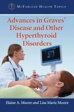 Advances in Graves' Disease and Other Hyperthyroid Disorders