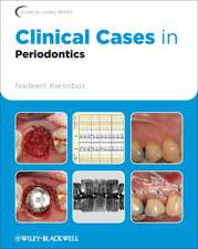 Clinical Cases in Periodontics