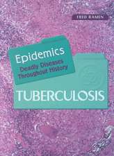 Tuberculosis