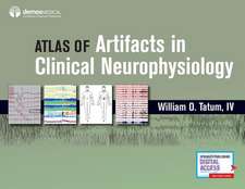 Atlas of Artifacts in Clinical Neurophysiology