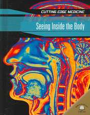 Seeing Inside the Body