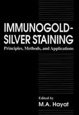 Immunogold-Silver Staining: Principles, Methods, and Applications