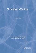 3D Imaging in Medicine, Second Edition