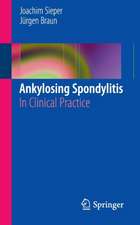 Ankylosing Spondylitis: In Clinical Practice