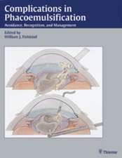 Complications in Phacoemulsification: Avoidance, Recognition, and Management