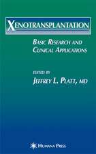 Xenotransplantation: Basic Research and Clinical Applications