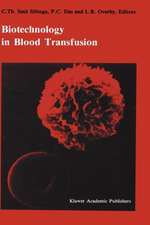 Biotechnology in blood transfusion: Proceedings of the Twelfth Annual Symposium on Blood Transfusion, Groningen 1987, organized by the Red Cross Blood Bank Groningen-Drenthe