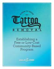 Tattoo Removal