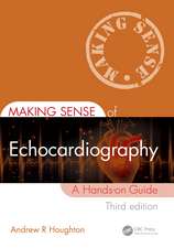 Making Sense of Echocardiography: A Hands-on Guide