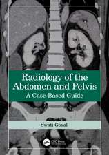 Radiology of the Abdomen and Pelvis: A Case-Based Guide