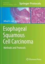 Esophageal Squamous Cell Carcinoma: Methods and Protocols