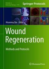 Wound Regeneration: Methods and Protocols