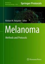 Melanoma: Methods and Protocols 