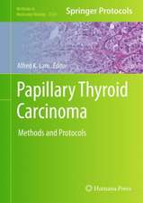 Papillary Thyroid Carcinoma: Methods and Protocols