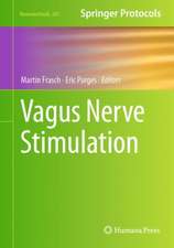 Vagus Nerve Stimulation