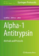 Alpha-1 Antitrypsin: Methods and Protocols